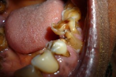 agape-medical-missions-camera3-2012-097